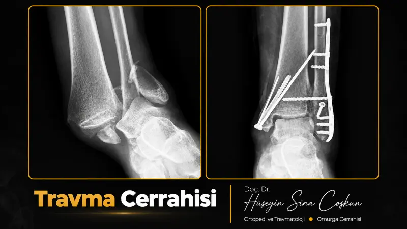 Travma cerrahisi: tedavi öncesi ve sonrası görüntüler