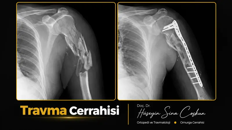 Travma cerrahisi: tedavi öncesi ve sonrası görüntüler